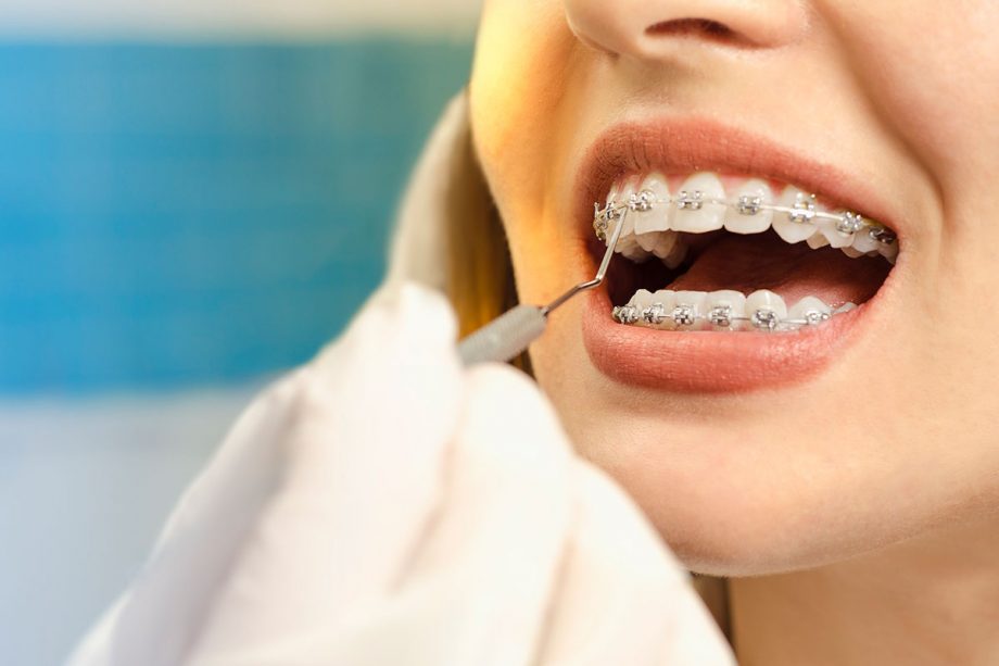 Advantages-And-Disadvantages-of-Orthodontics